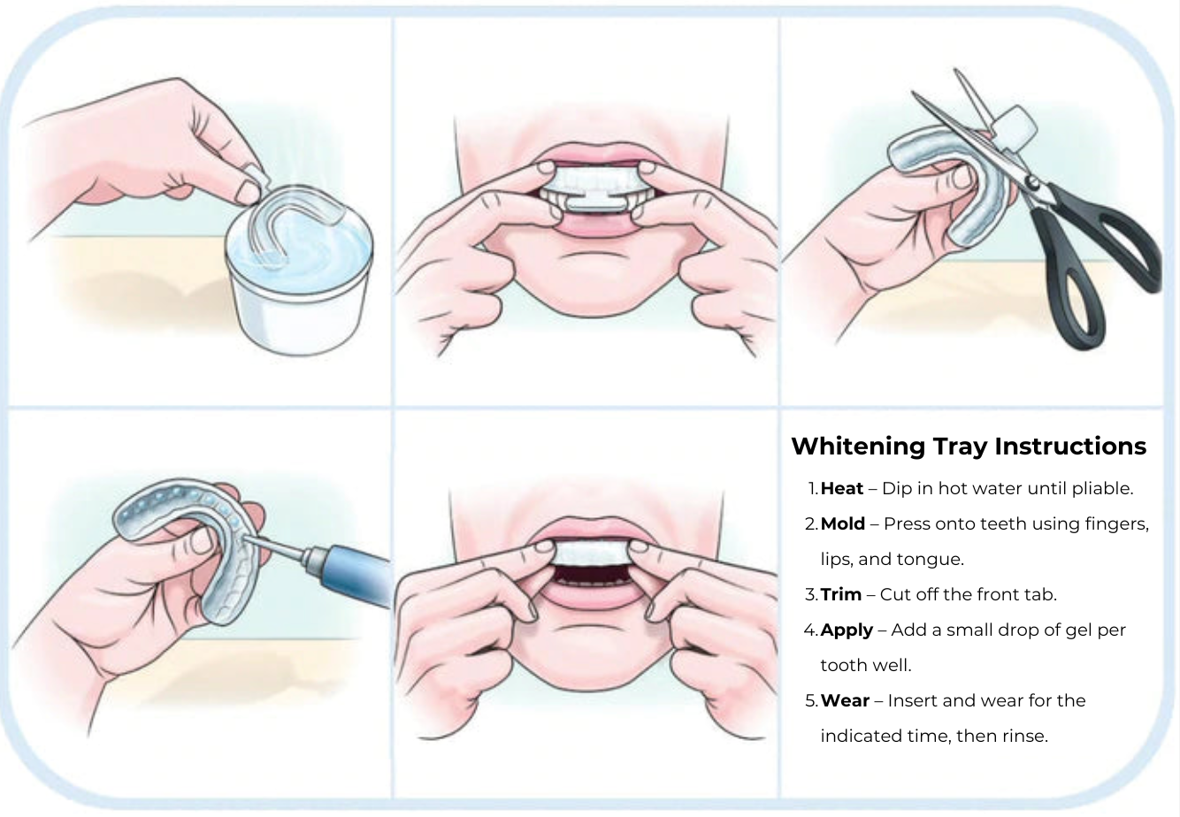 Thermosculp Trays